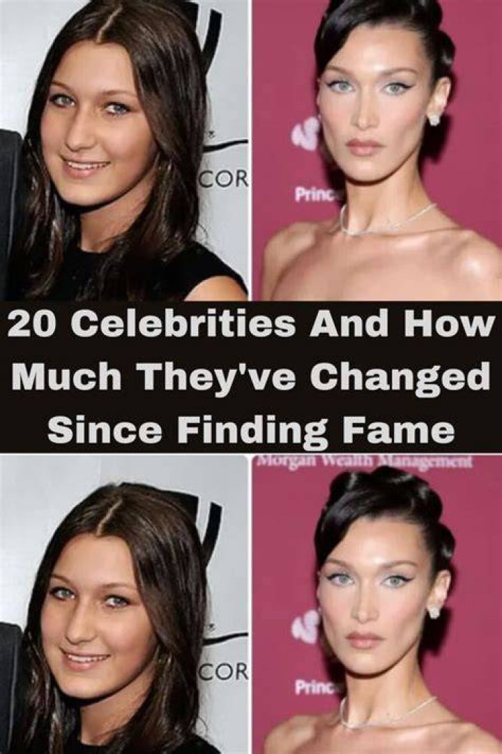 20 celebrities and what they would look like without plas...