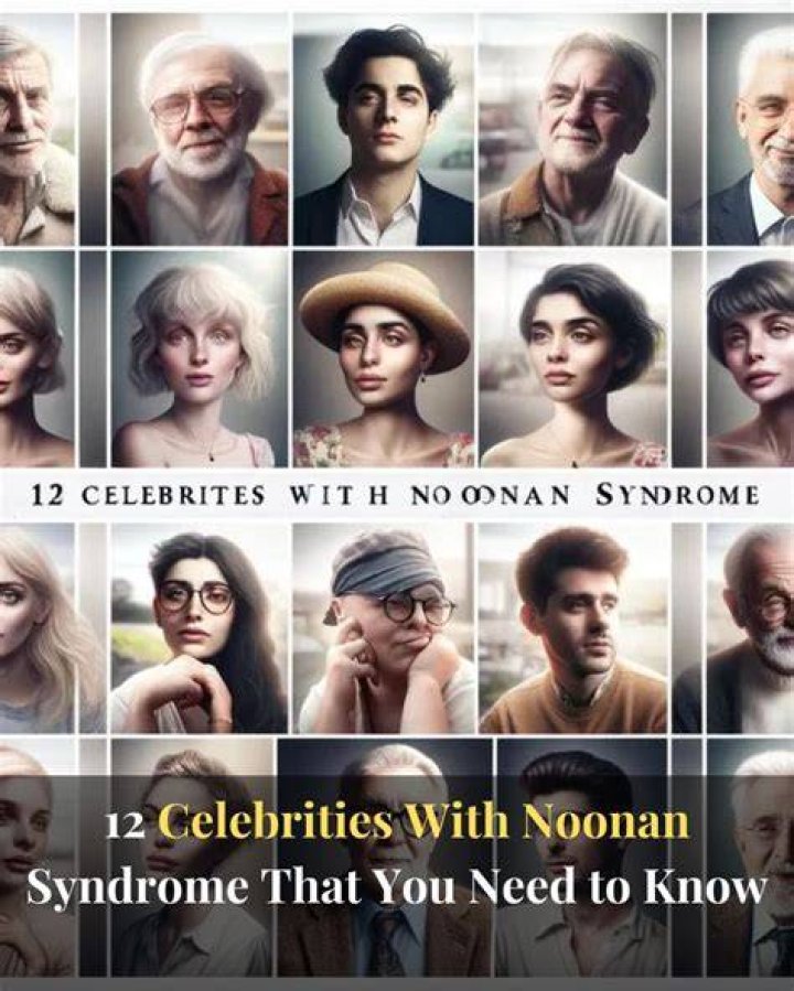 Famous Faces Of Noonan Syndrome Celebrities With This Rare Condition