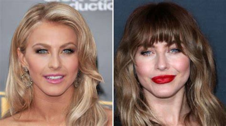 Julianne Hough Plastic Surgery Photos [Before & After] Surgery4
