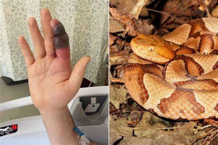 Venomous copperhead snake bites man in New Jersey YouTube