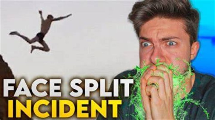 When A Guy Splits Face: The Shocking Incident That Left Everyone Speechless